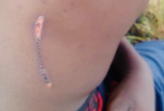 “I was assaulted and tortured by Nhlangano Police Station cops and health workers are demanding a police report,” says Sandile Bravo Motsa of Zombodze Emvuma -Sigijimini.