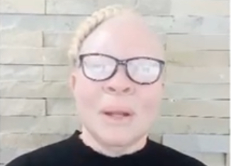 Swaziland News editor Zweli Martin Dlamini donates R10,000.00 to Stukie Motsa Foundation, money to assist in buying eye glasses for children with albinism.